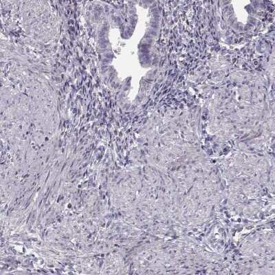 Immunohistochemistry-Paraffin: SLCO6A1 Antibody [NBP2-49118]