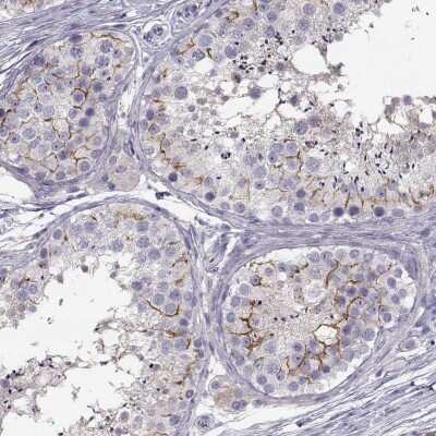 Immunohistochemistry-Paraffin: SLCO6A1 Antibody [NBP2-49118]