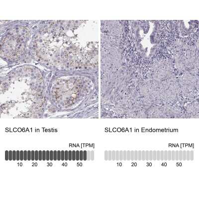 Immunohistochemistry-Paraffin: SLCO6A1 Antibody [NBP2-49118]