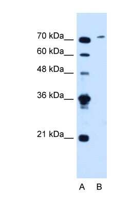 Western Blot: SLCO6A1 Antibody [NBP1-59899]