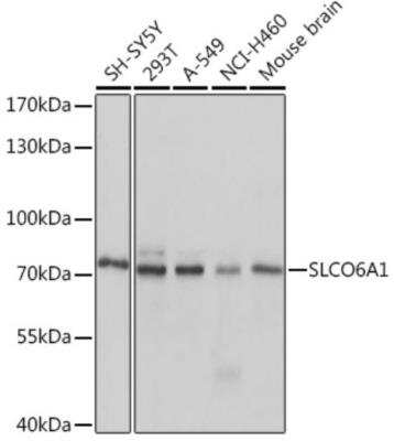 Western Blot: SLCO6A1 AntibodyAzide and BSA Free [NBP2-95132]