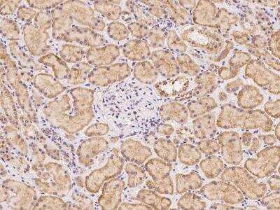 Immunohistochemistry-Paraffin: SLFN12 Antibody [NBP3-06230]