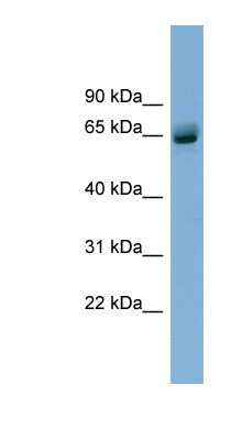 Western Blot: SLFN12 Antibody [NBP1-70706]