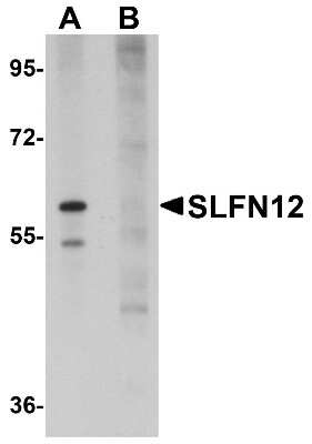 Western Blot: SLFN12 AntibodyBSA Free [NBP1-76252]