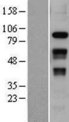 Western Blot: SLFN12 Overexpression Lysate [NBP2-06881]