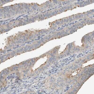 Immunohistochemistry-Paraffin: SLFN12L Antibody [NBP1-91060]