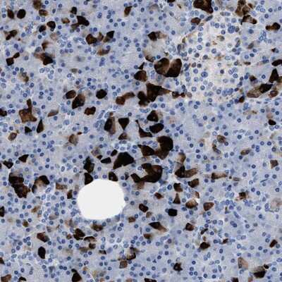 Immunohistochemistry-Paraffin: SLFN13 Antibody [NBP1-93880]