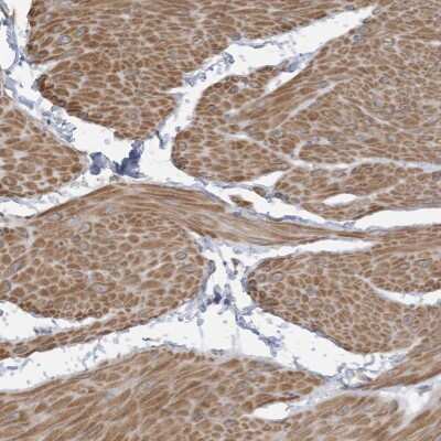 Immunohistochemistry: SLFN14 Antibody [NBP2-33896]