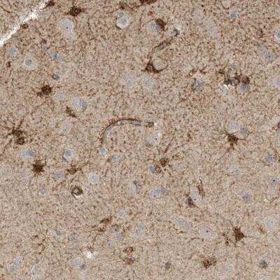 Immunohistochemistry-Paraffin: SLFN14 Antibody [NBP1-91068]