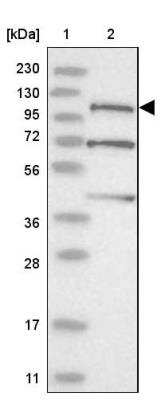 Western Blot: SLFN14 Antibody [NBP2-33896]