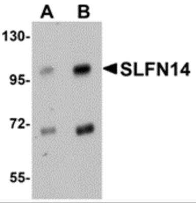 Western Blot: SLFN14 AntibodyBSA Free [NBP2-82010]