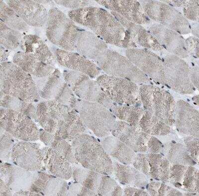 Immunohistochemistry-Paraffin: SLFN5 Antibody [NBP1-81178]