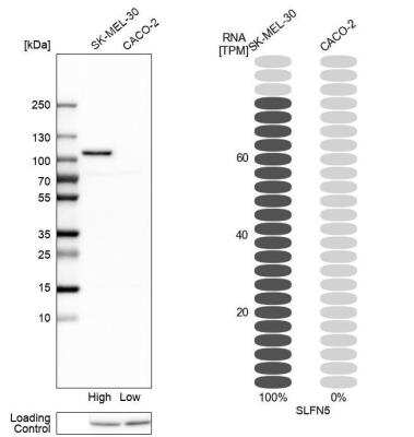 Western Blot: SLFN5 Antibody [NBP1-81178]