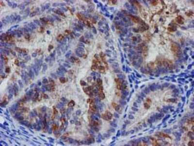 Immunohistochemistry-Paraffin: SLFNL1 Antibody (OTI1G2) [NBP2-03192]