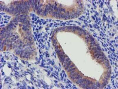 Immunohistochemistry-Paraffin: SLFNL1 Antibody (OTI1G2) [NBP2-03192]