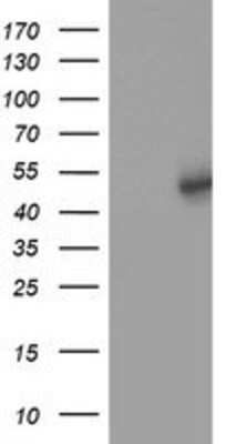 Western Blot: SLFNL1 Antibody (OTI1G2) [NBP2-03192]