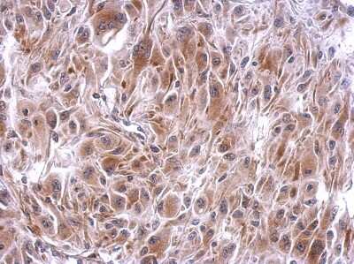 Immunohistochemistry-Paraffin: SLFNL1 Antibody [NBP2-20397]