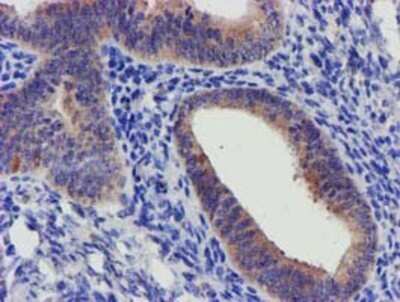 Immunohistochemistry: SLFNL1 Antibody (OTI1G2) - Azide and BSA Free [NBP2-74223]