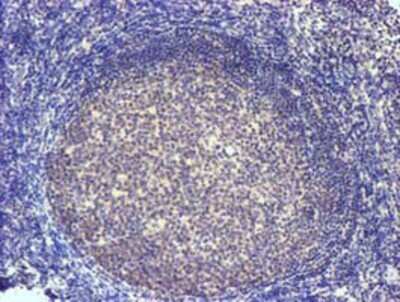 Immunohistochemistry: SLFNL1 Antibody (OTI1G2) - Azide and BSA Free [NBP2-74223]