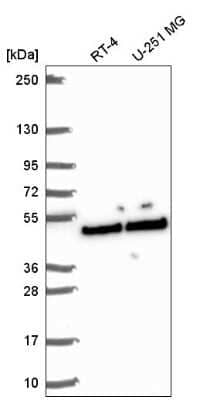 Western Blot: SLFNL1 Antibody [NBP2-58744]