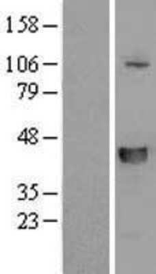 Western Blot: SLFNL1 Overexpression Lysate [NBL1-16209]