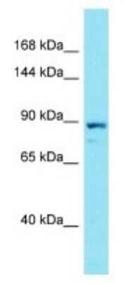 Western Blot: SLIP-GC Antibody [NBP3-09675]