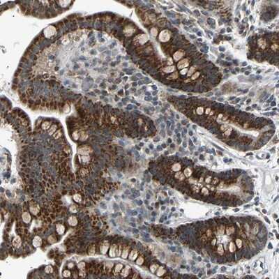Immunohistochemistry-Paraffin: SLIRP Antibody [NBP1-85285]