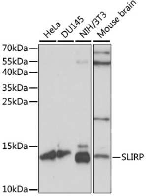 Western Blot: SLIRP AntibodyAzide and BSA Free [NBP2-93150]