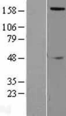 Western Blot: Slit2 Overexpression Lysate [NBL1-16210]