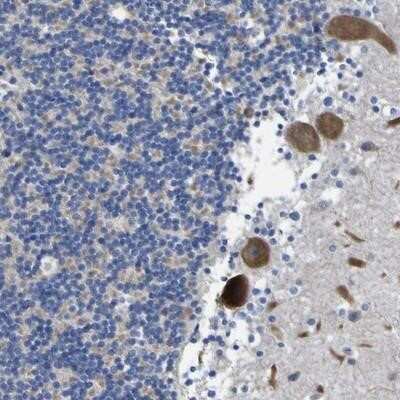 Immunohistochemistry-Paraffin: SLITRK1 Antibody [NBP1-82882]