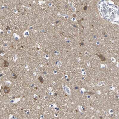 Immunohistochemistry-Paraffin: SLITRK1 Antibody [NBP1-82882]