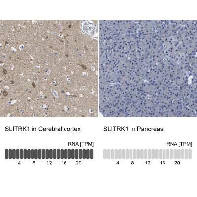 Immunohistochemistry-Paraffin: SLITRK1 Antibody [NBP1-82882]