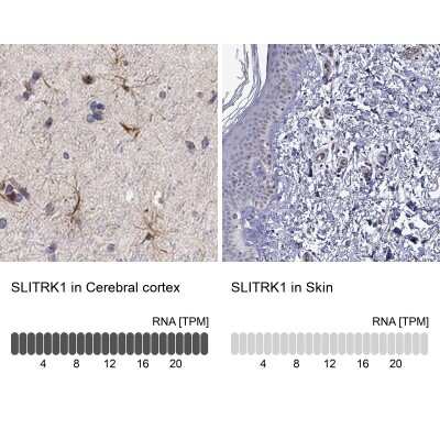 Immunohistochemistry-Paraffin: SLITRK1 Antibody [NBP3-16976]