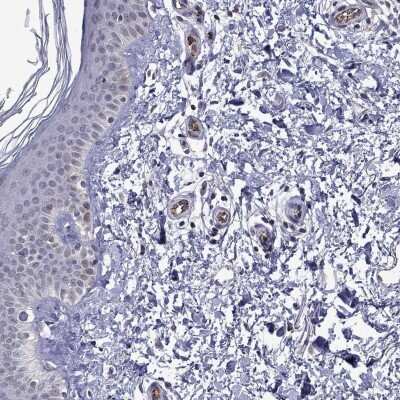Immunohistochemistry-Paraffin: SLITRK1 Antibody [NBP3-16976]