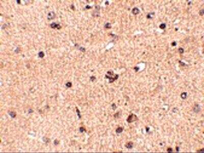 Immunohistochemistry: SLITRK2 Antibody - BSA Free [NBP2-81840]