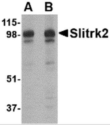 Western Blot: SLITRK2 AntibodyBSA Free [NBP2-81840]