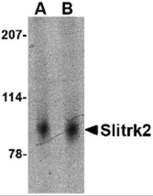 Western Blot: SLITRK2 AntibodyBSA Free [NBP2-81841]