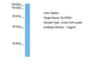 Western Blot: SLITRK2 Antibody [NBP2-82346]