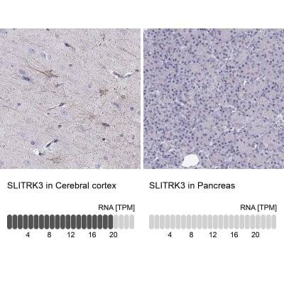 Immunohistochemistry-Paraffin: SLITRK3 Antibody [NBP2-62616]