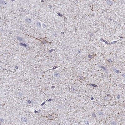 Immunohistochemistry-Paraffin: SLITRK3 Antibody [NBP2-62616]