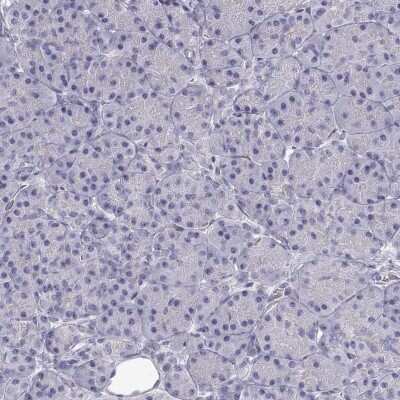 Immunohistochemistry-Paraffin: SLITRK3 Antibody [NBP2-62616]