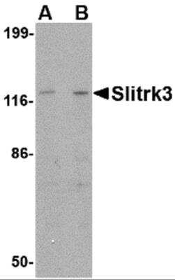 Western Blot: SLITRK3 AntibodyBSA Free [NBP2-81808]