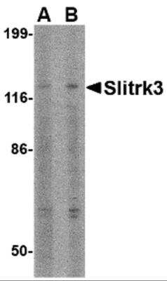 Western Blot: SLITRK3 AntibodyBSA Free [NBP2-81815]