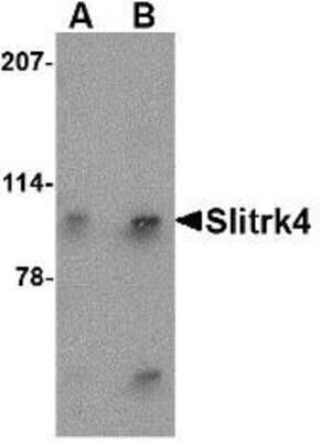 Western Blot: SLITRK4 AntibodyBSA Free [NBP1-76875]