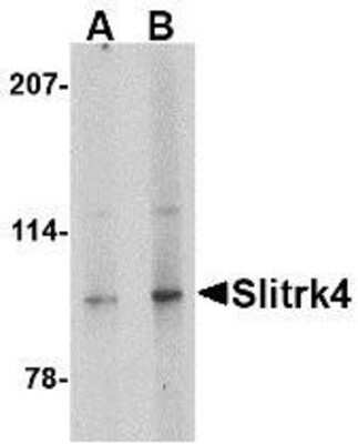 Western Blot: SLITRK4 AntibodyBSA Free [NBP1-76878]