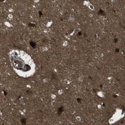 Immunohistochemistry-Paraffin: SLITRK5 Antibody [NBP1-90798]