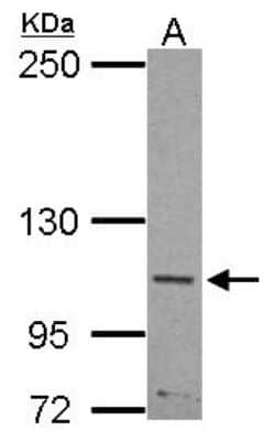 Western Blot: SLITRK5 Antibody [NBP2-20400]