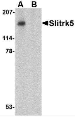 Western Blot: SLITRK5 AntibodyBSA Free [NBP2-81914]