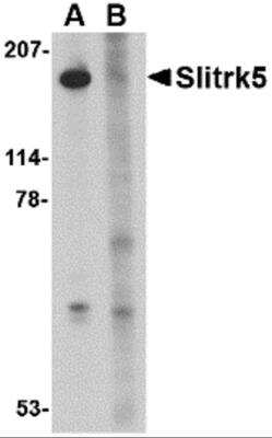 Western Blot: SLITRK5 AntibodyBSA Free [NBP2-81915]