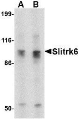 Western Blot: SLITRK6 AntibodyBSA Free [NBP1-76876]